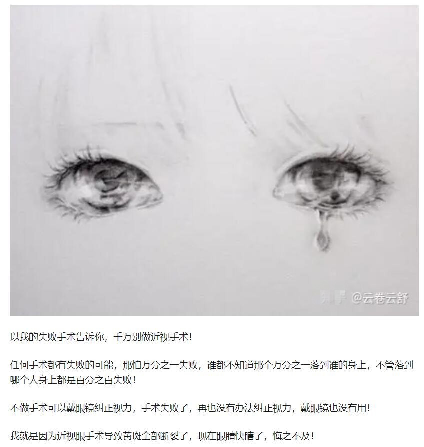 教你，怎樣去了解近視手術  